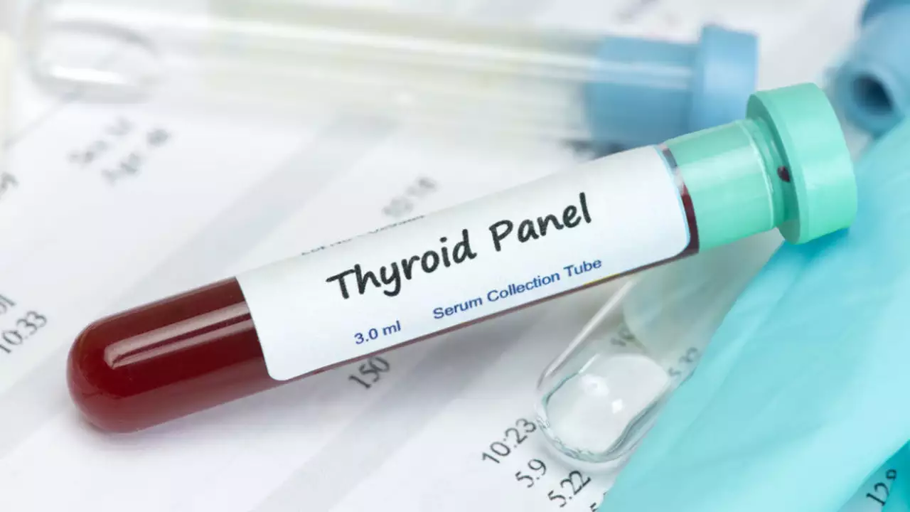 Labetalol and Thyroid Function: What You Need to Know
